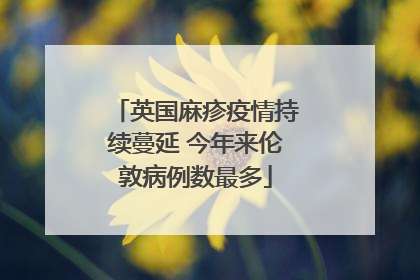 英国麻疹疫情持续蔓延 今年来伦敦病例数最多